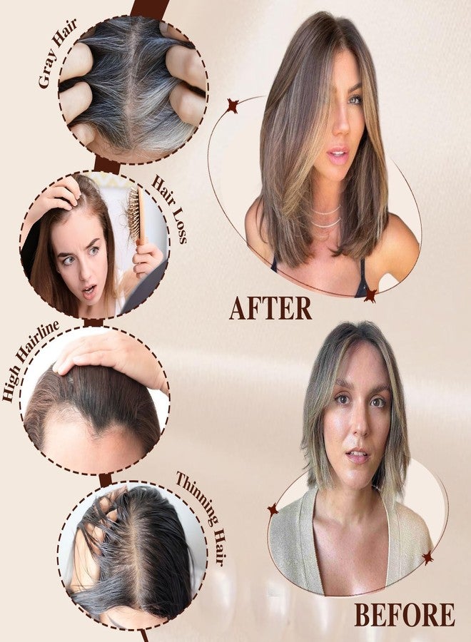 starluck 14-Inch Chestnut Brown & Honey Blonde Topper – Synthetic Hairpiece, Swiss Base with 3 Clips – Ideal for Thinning or Grey Hair, Women’s Wiglet for Volume & Coverage - Image 4